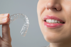 invisalign vs smile direct club