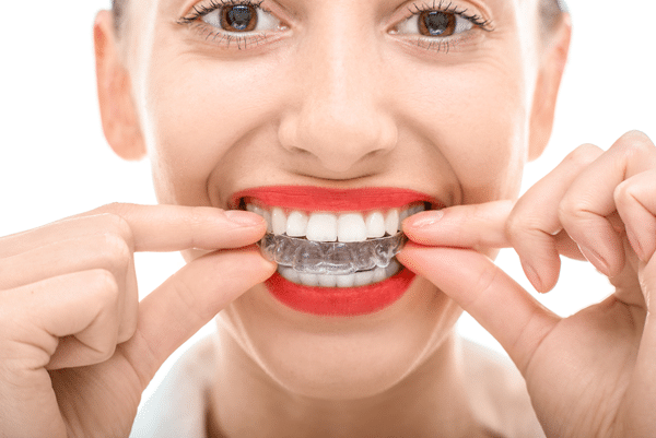 cost of invisalign brooklyn