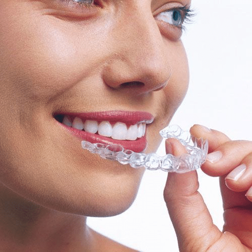 The Benefits Of Invisalign Hanson Place Orthodontics