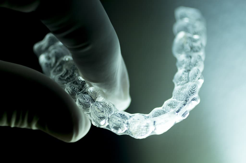 Can Invisalign Fix my Underbite?