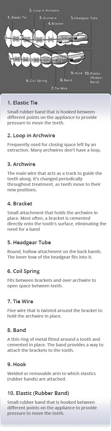 Braces Diagram