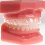 retainers