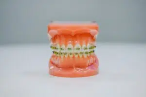 Fix Crooked Teeth