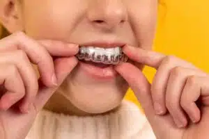 Straight Teeth with Invisalign