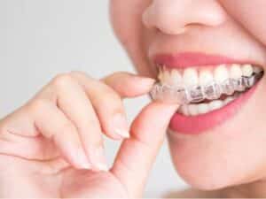 Invisalign Insurance