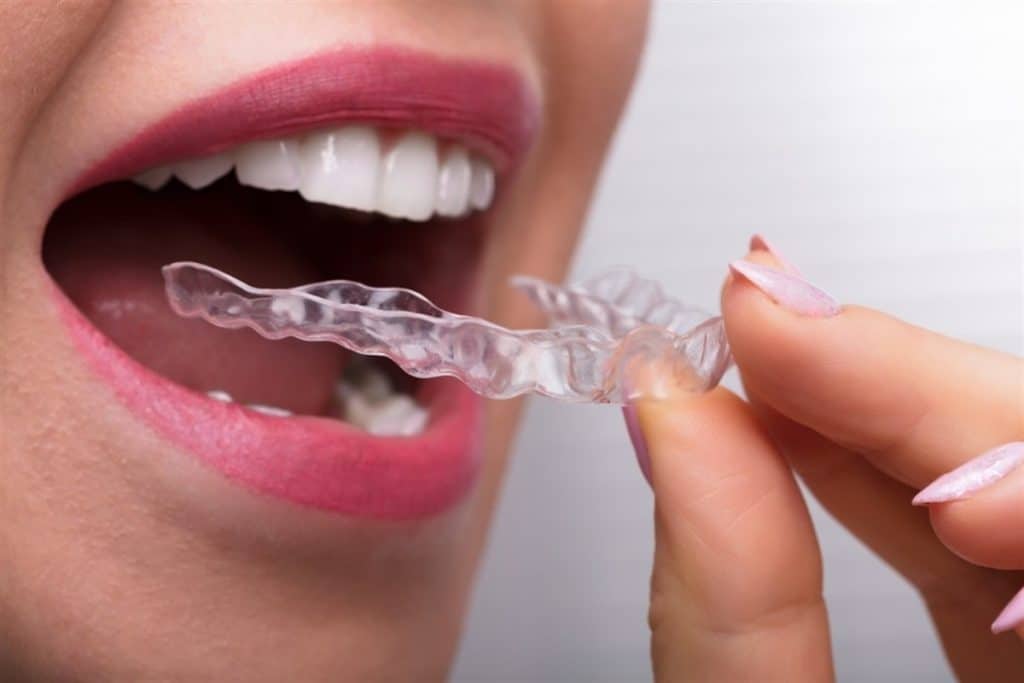 adult orthodontic treatment