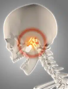 orthodontics and jaw pain