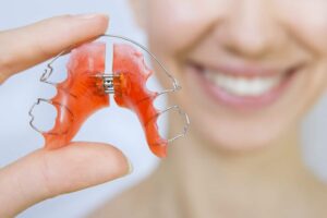 Essential Role of Retainers