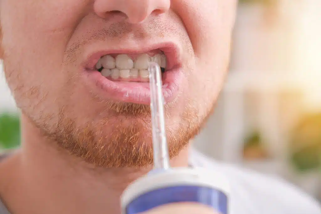 Best Water Flosser for Braces and Orthodontic Care