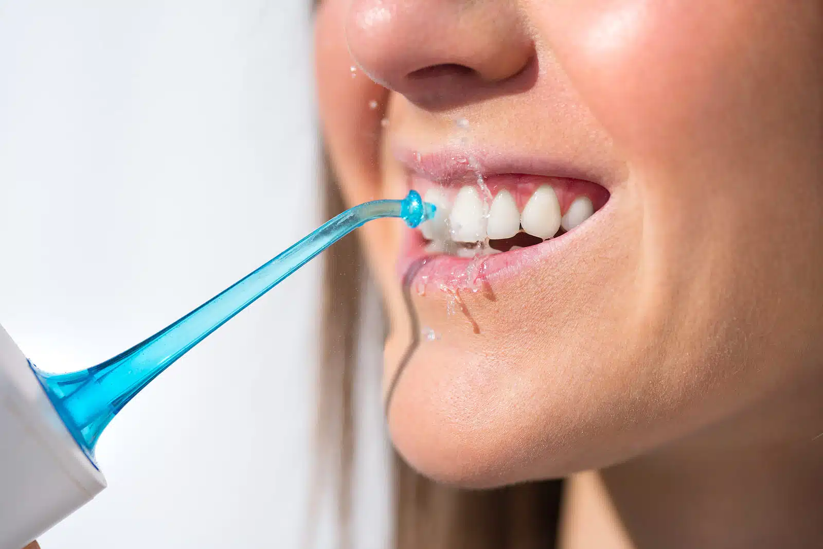 Using a Water Flosser for Braces at Home