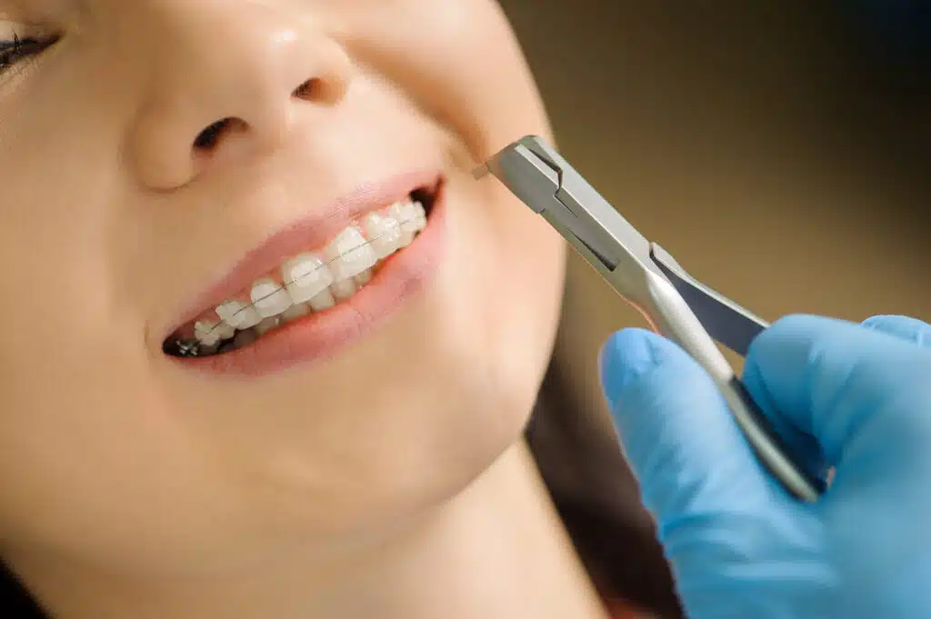 Candidate for LightForce Braces